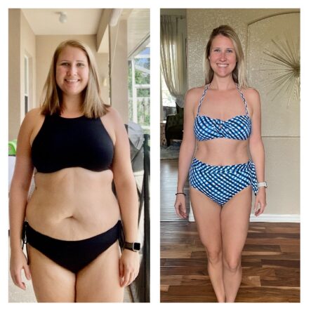 Woman in side by side photos in bathing suit before and after weight loss.