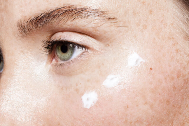 Closeup of woman's eye with lotion dotted underneath.