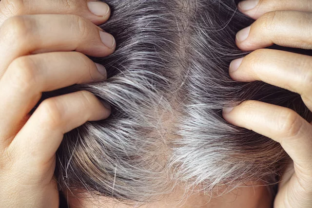 A woman with gray roots due to aging, genetics, stress, smoking, and more