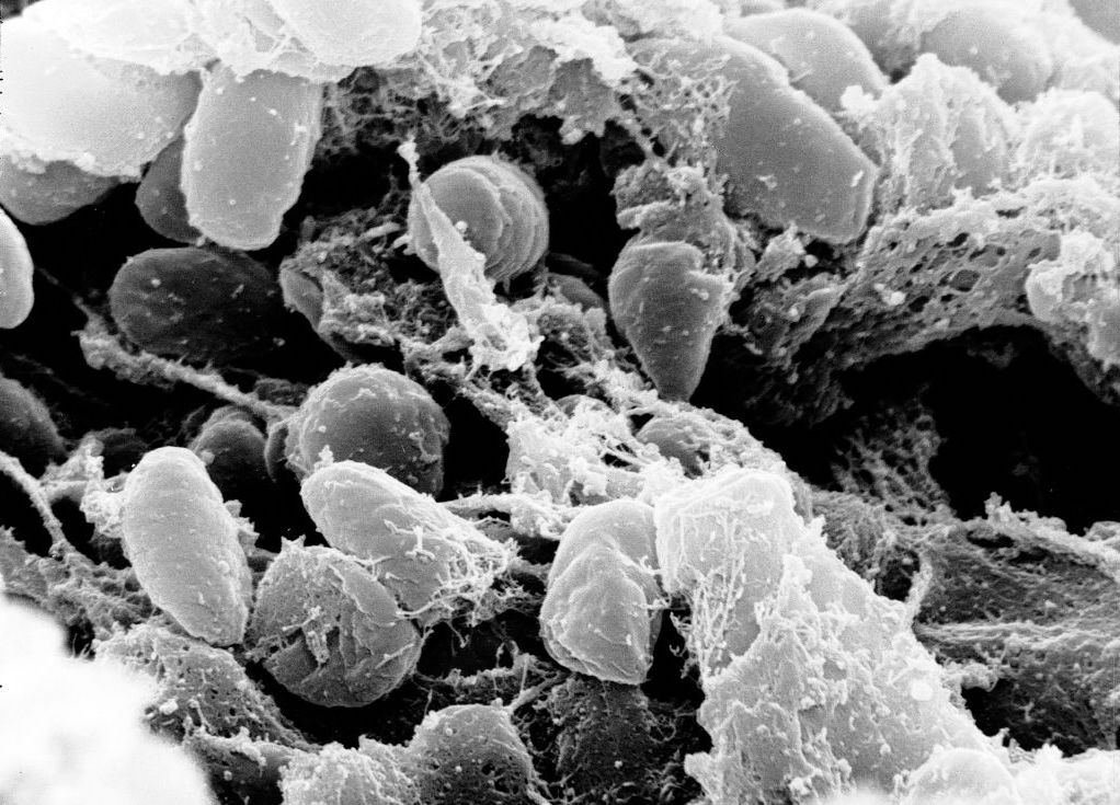 Scanning electron micrograph depicting a mass of <i>Yersinia pestis </i> bacteria (the cause of bubonic plague) in the foregut of the flea vector. 