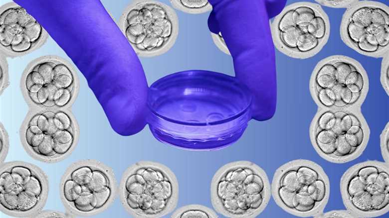 IVF Patients Claim a Test Made Them Discard Embryos. Now they're Suing