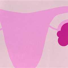 ovarian cysts