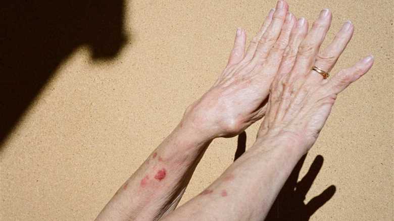 What Two 98-Year Old Patients Taught Me about Longevity