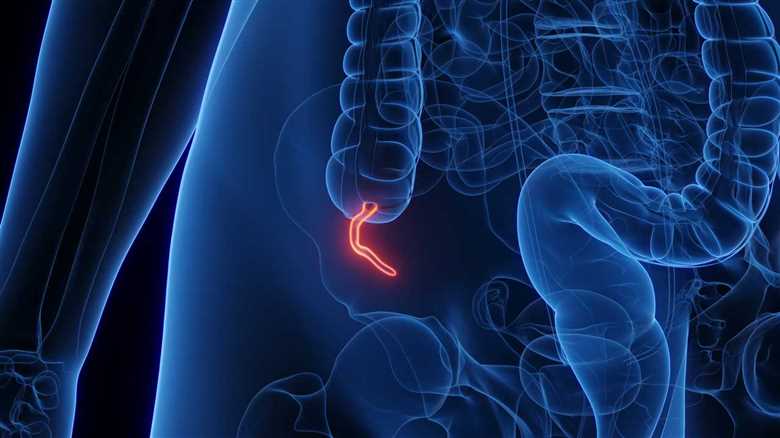 The Appendix Cancer Rate Has Quadrupled Among Millennials