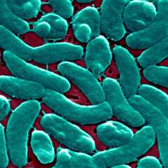 ‘Flesh-Eating’ Bacteria Cases Are on the Rise Along the Gulf Coast. How Do You Get It, and How Can You Protect Yourself?